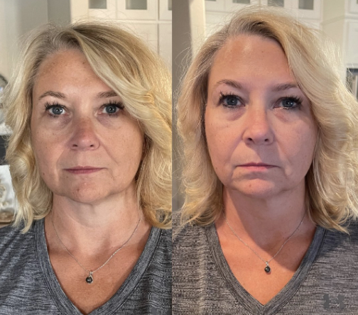 You need this!!! Not only does it help with hair, skin, and nails, but my gut health and joint discomfort have improved beyond my expectations!